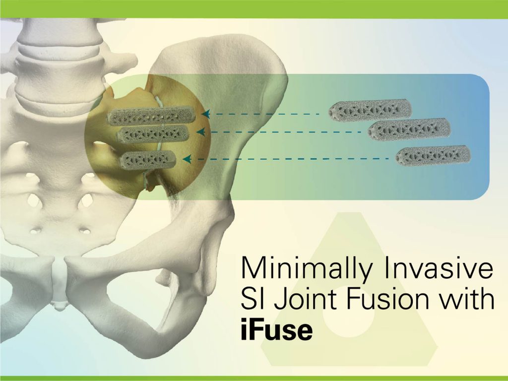 Si Bone Women Neurosurgeons Symposium Series