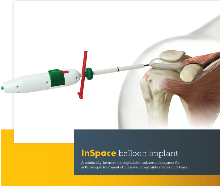 inspace-balloon-implant